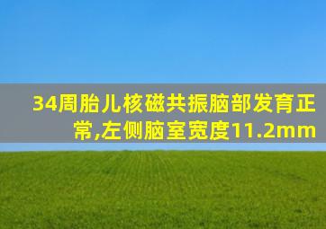 34周胎儿核磁共振脑部发育正常,左侧脑室宽度11.2mm
